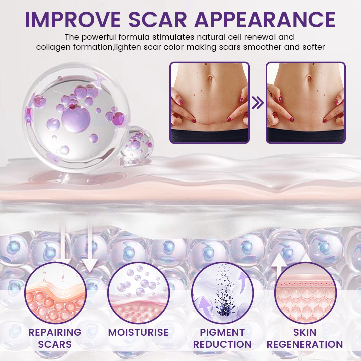 Glisklean scar gel application benefits