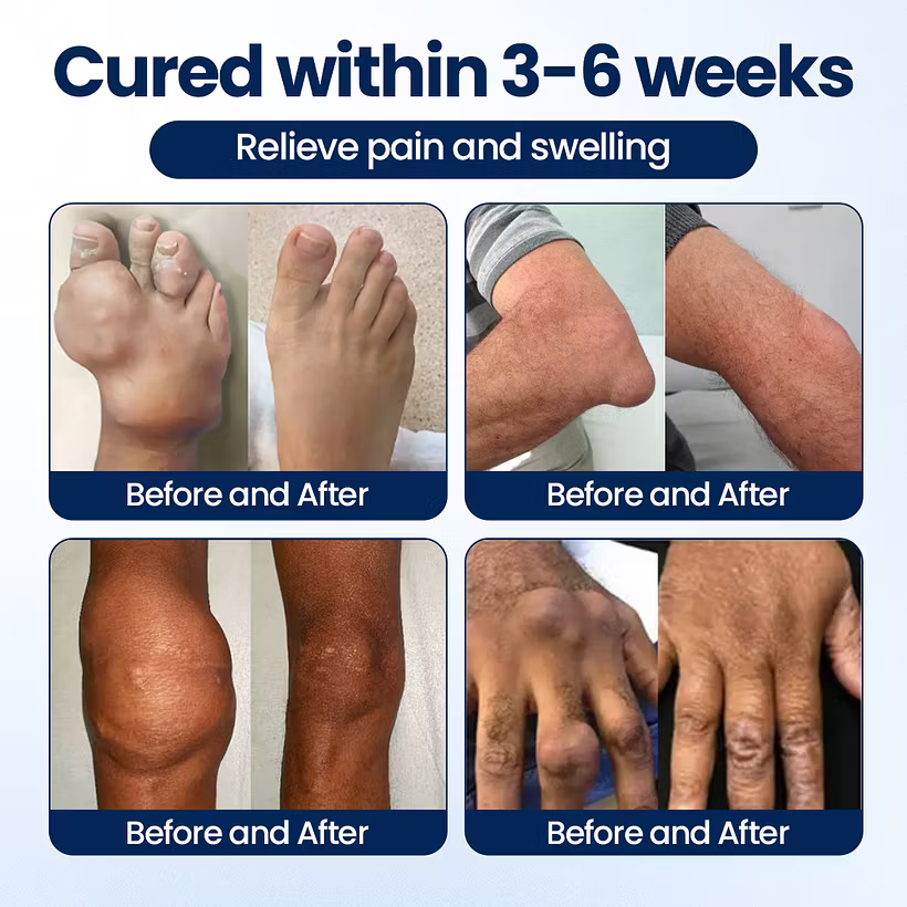 Dreamy Results® ArthriNAD+ Pro Advanced Joint Recovery Cream