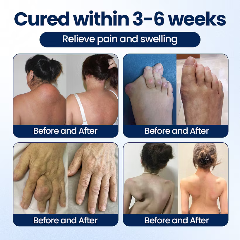 Dreamy Results® ArthriNAD+ Pro Advanced Joint Recovery Cream