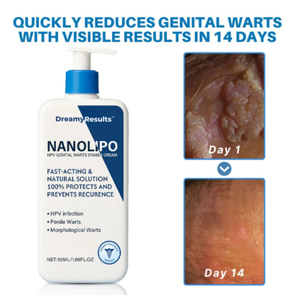 DreamyResults® NanoLipo HPV Warts Eraser Cream