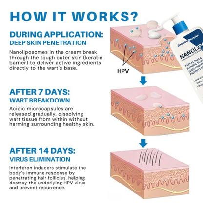 DreamyResults® NanoLipo HPV Warts Eraser Cream