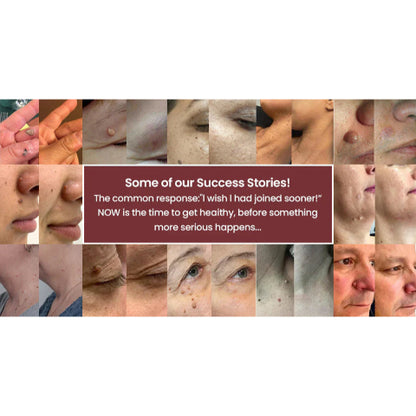 DreamyResults® 2-in-1 Microneedle & Hydrocolloid Patch