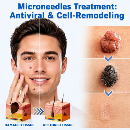 DreamyResults® 2-in-1 Microneedle & Hydrocolloid Patch