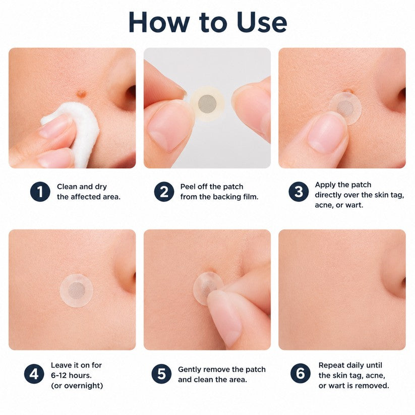 DreamyResults® 2-in-1 Microneedle & Hydrocolloid Patch