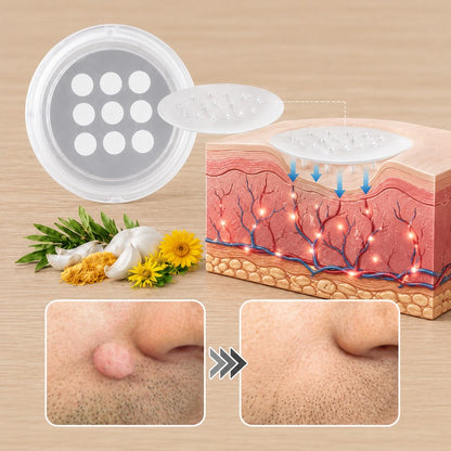 DreamyResults® 2-in-1 Microneedle & Hydrocolloid Patch